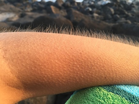 goosebumps-885563__340.jpg