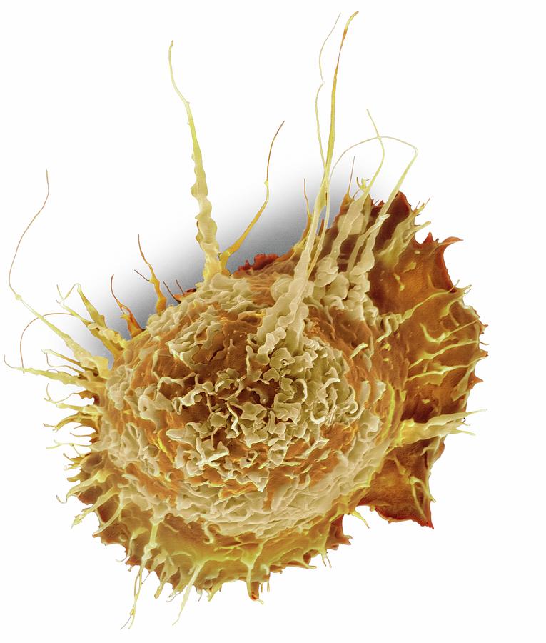 3-alveolar-macrophage-dennis-kunkel-microscopyscience-photo-library.jpg