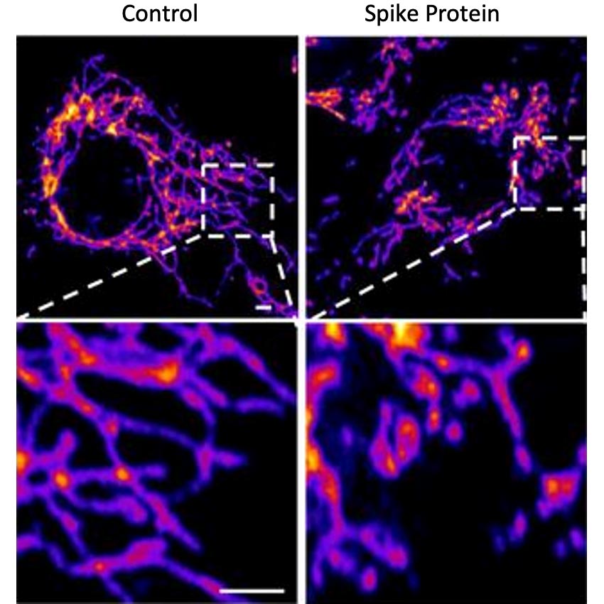 SARS-CoV-2-Spike-Protein-Vascular-Endothelial-Cells.jpg