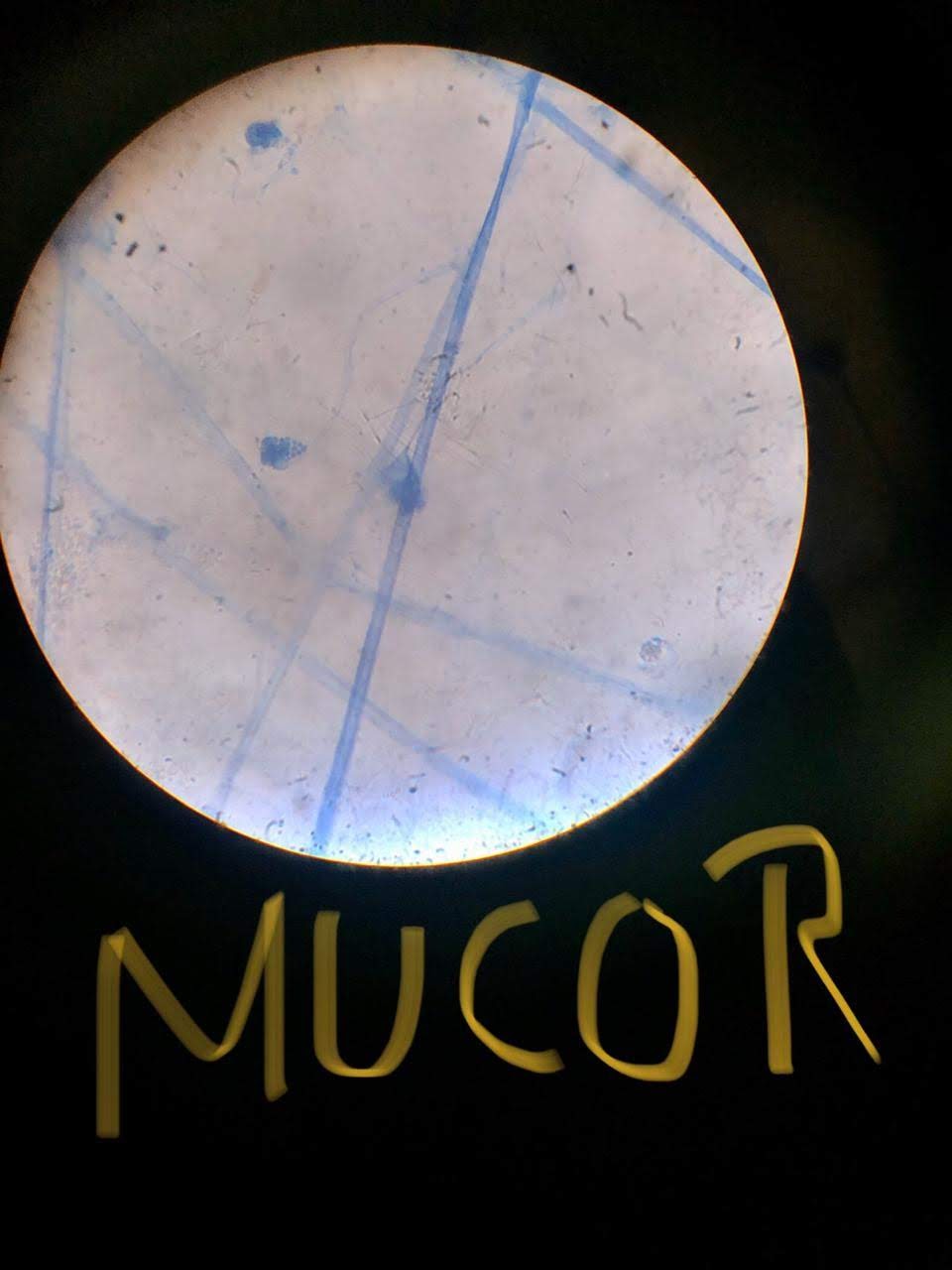 Mucor.jpeg