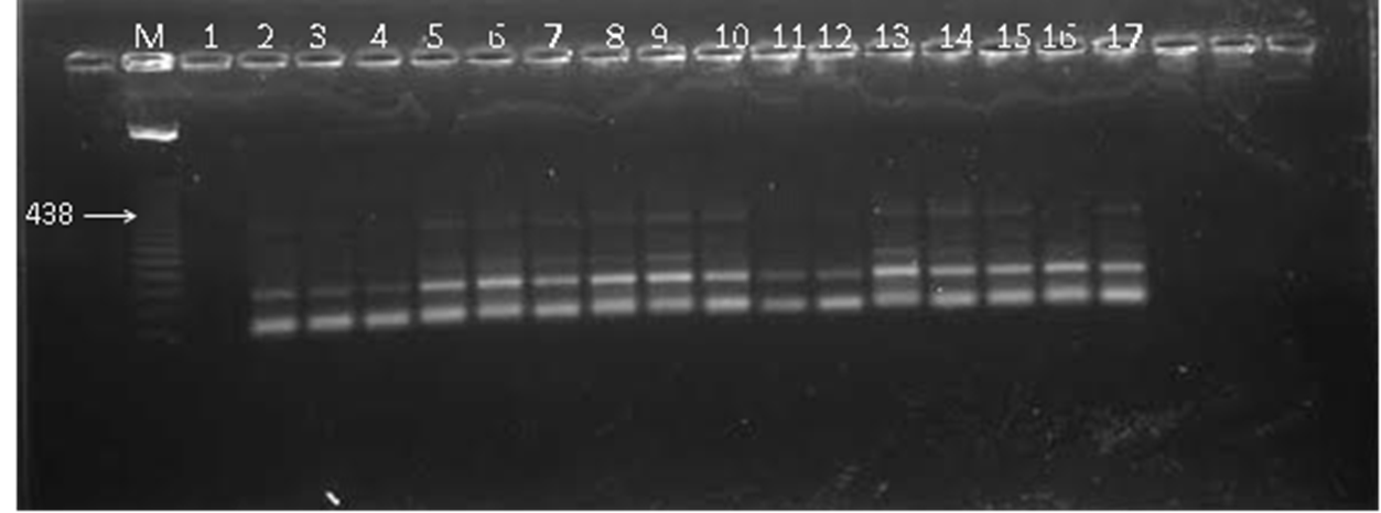 PCR bacterias.png