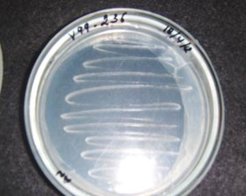 cultivo bacteriano.jpg