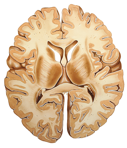 brain-cross-section.jpg