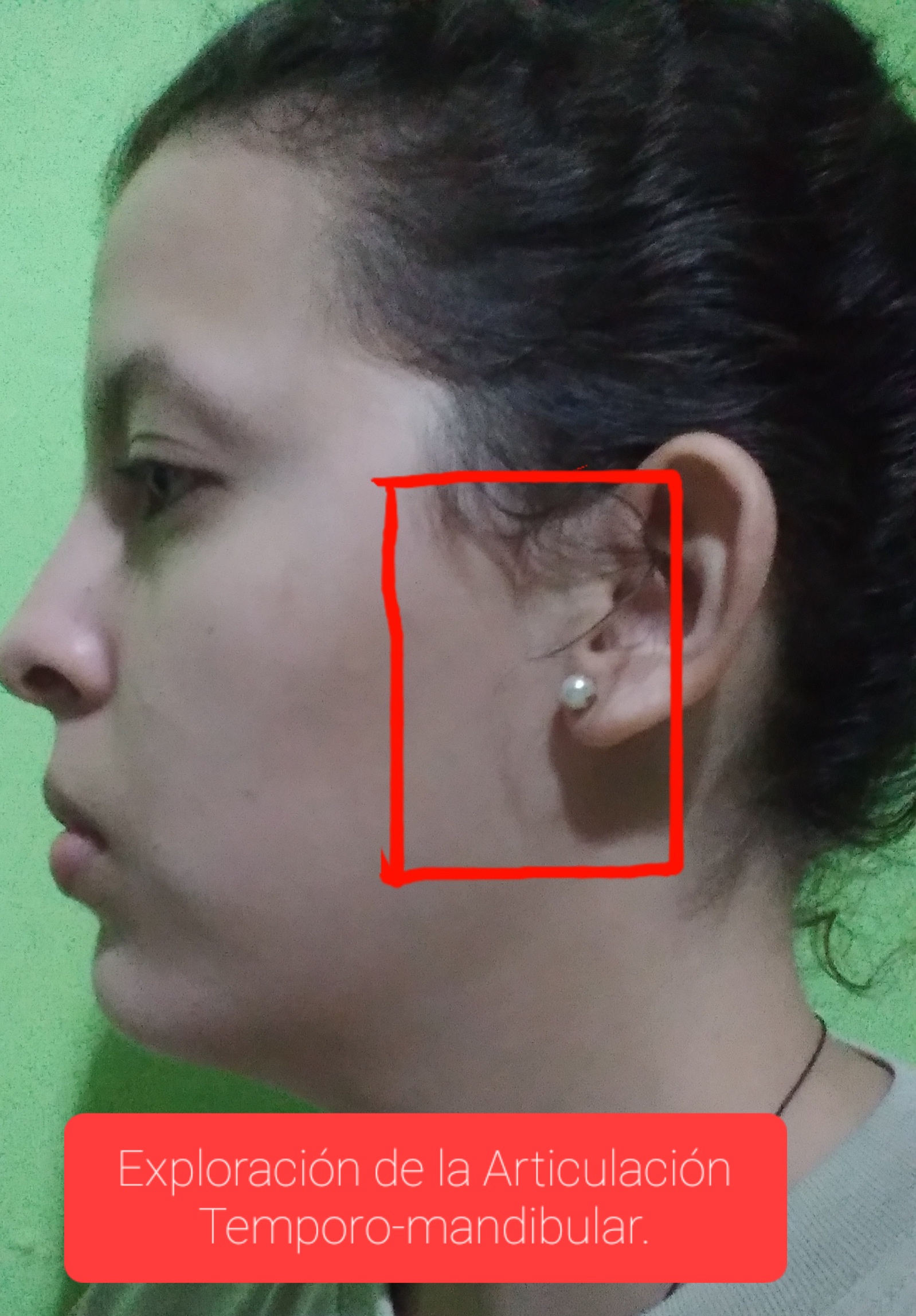 ¿Como palpar e inspeccionar la articulación temporomandibular ATM ...