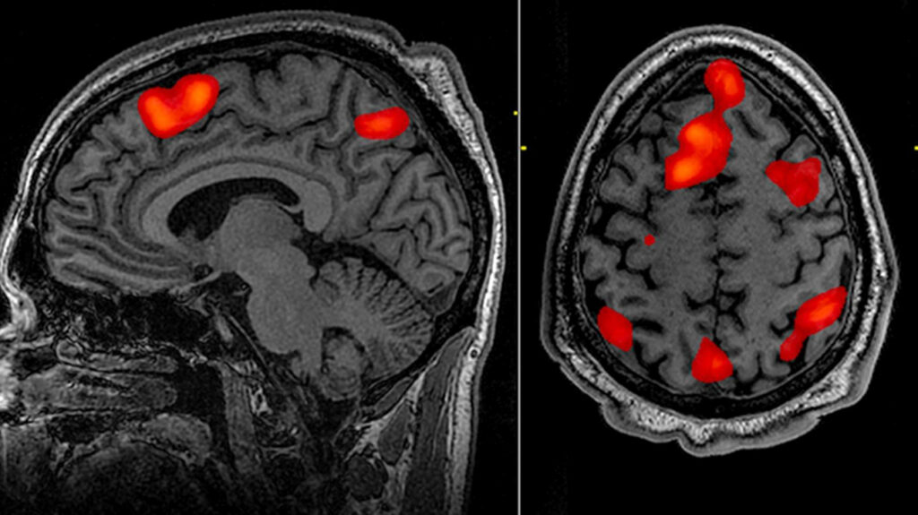 FMRI-brain-scan-1296x728-header-1024x575.jpg