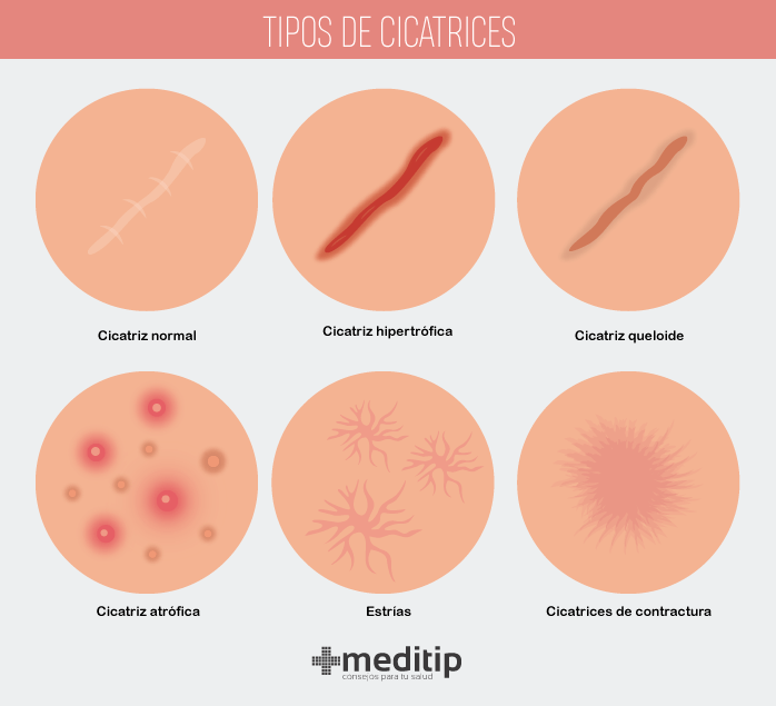 Medicina For Dummies Heridas Y Cicatrización — Hive 7168