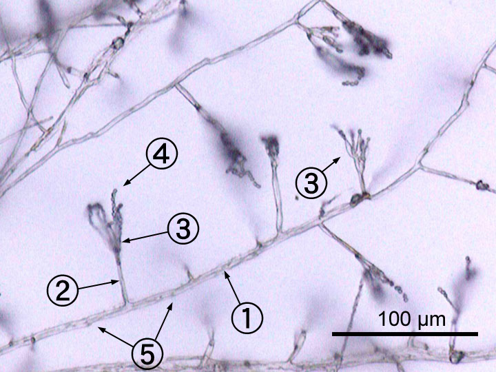 Penicillium_labeled.jpg