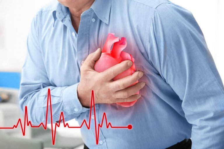 Heart-Attack-blog-768x512.jpg