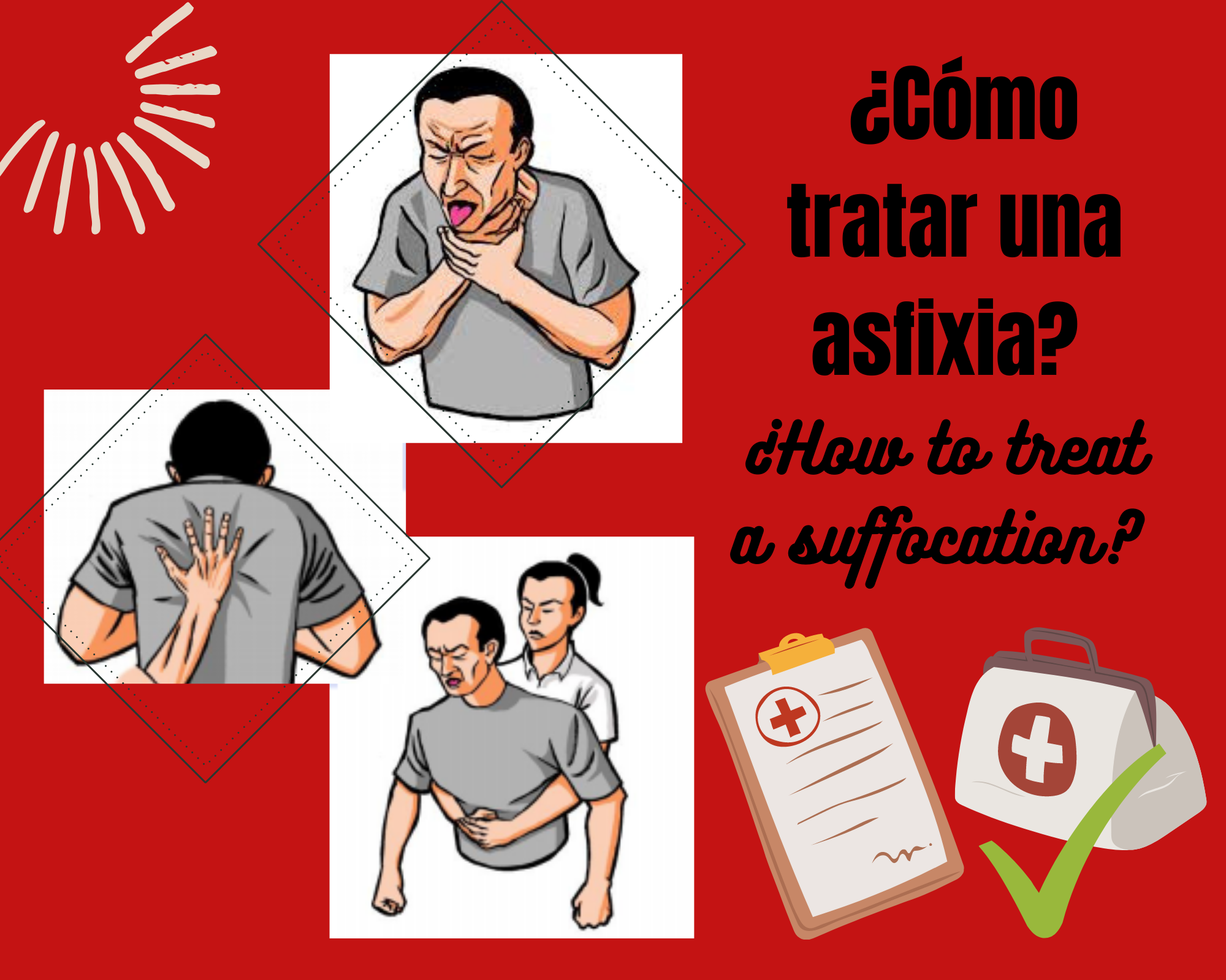 ¿Cómo tratar una asfixia.png