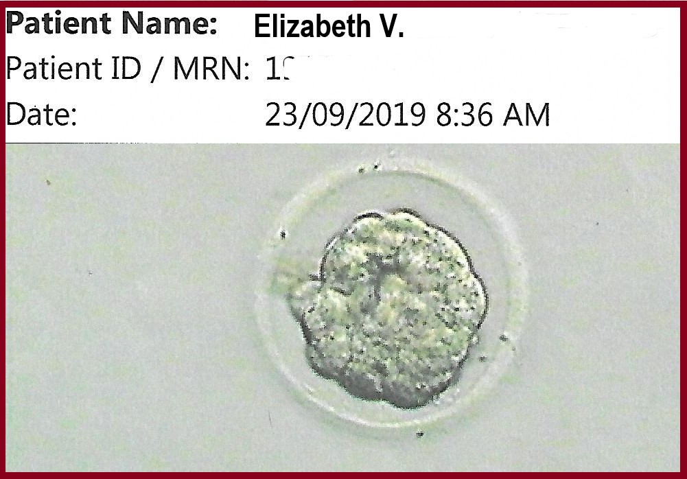embryo.jpg
