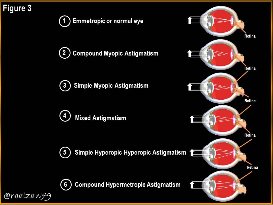 Figure_3..jpg