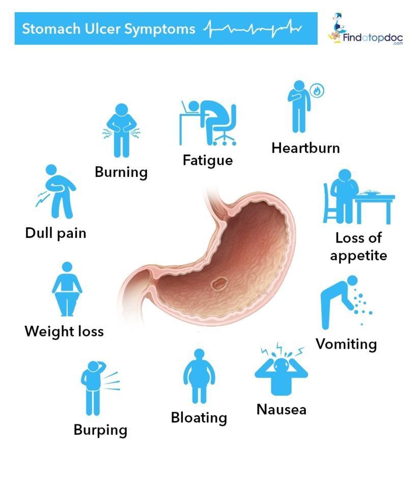 Stomach-Ulcer-Symptoms.jpg