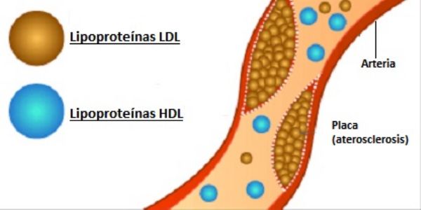 tipos-colesterol.jpg