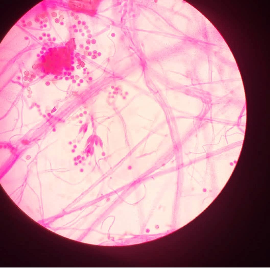 penicillium.jpg