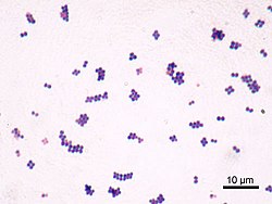 250px-Staphylococcus_aureus_Gram.jpg