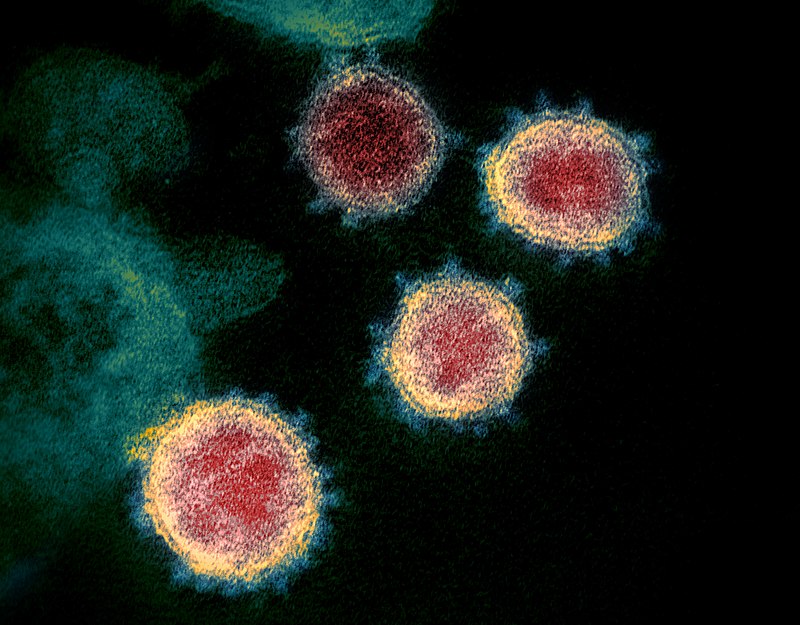 Novel_Coronavirus_SARS-CoV-2.jpg