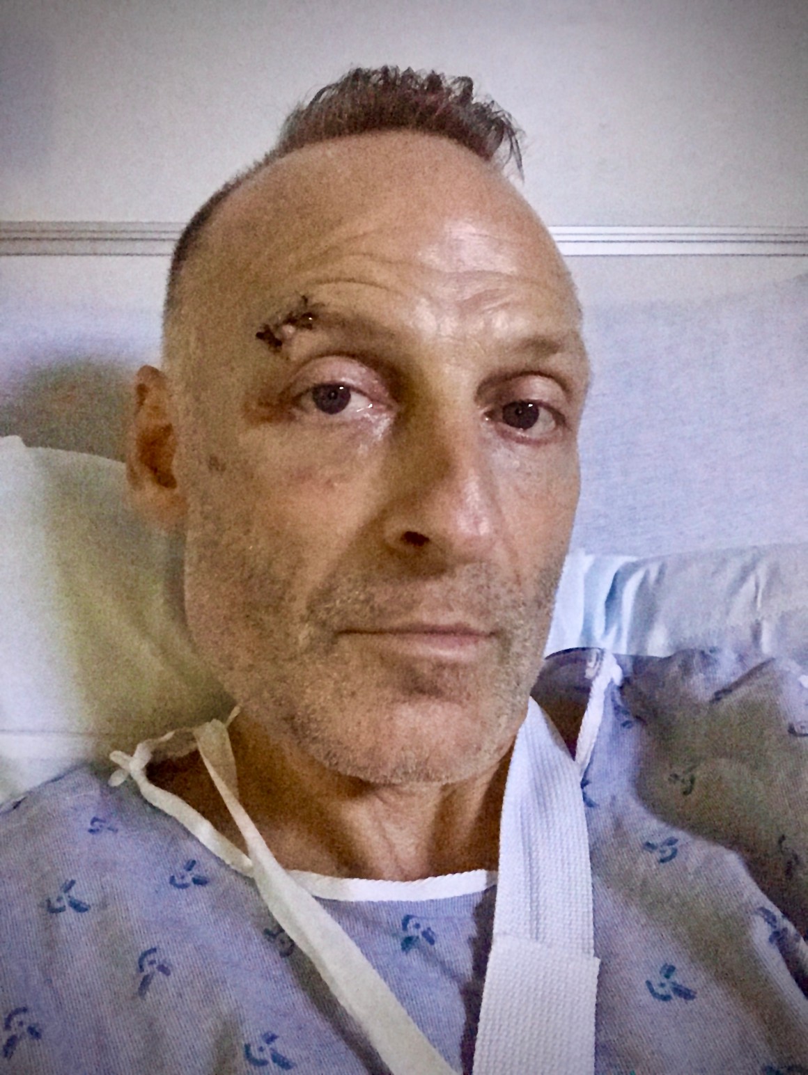 robb_gorringe_in hospital_after_pitbull_attack_in_hawaii.jpg