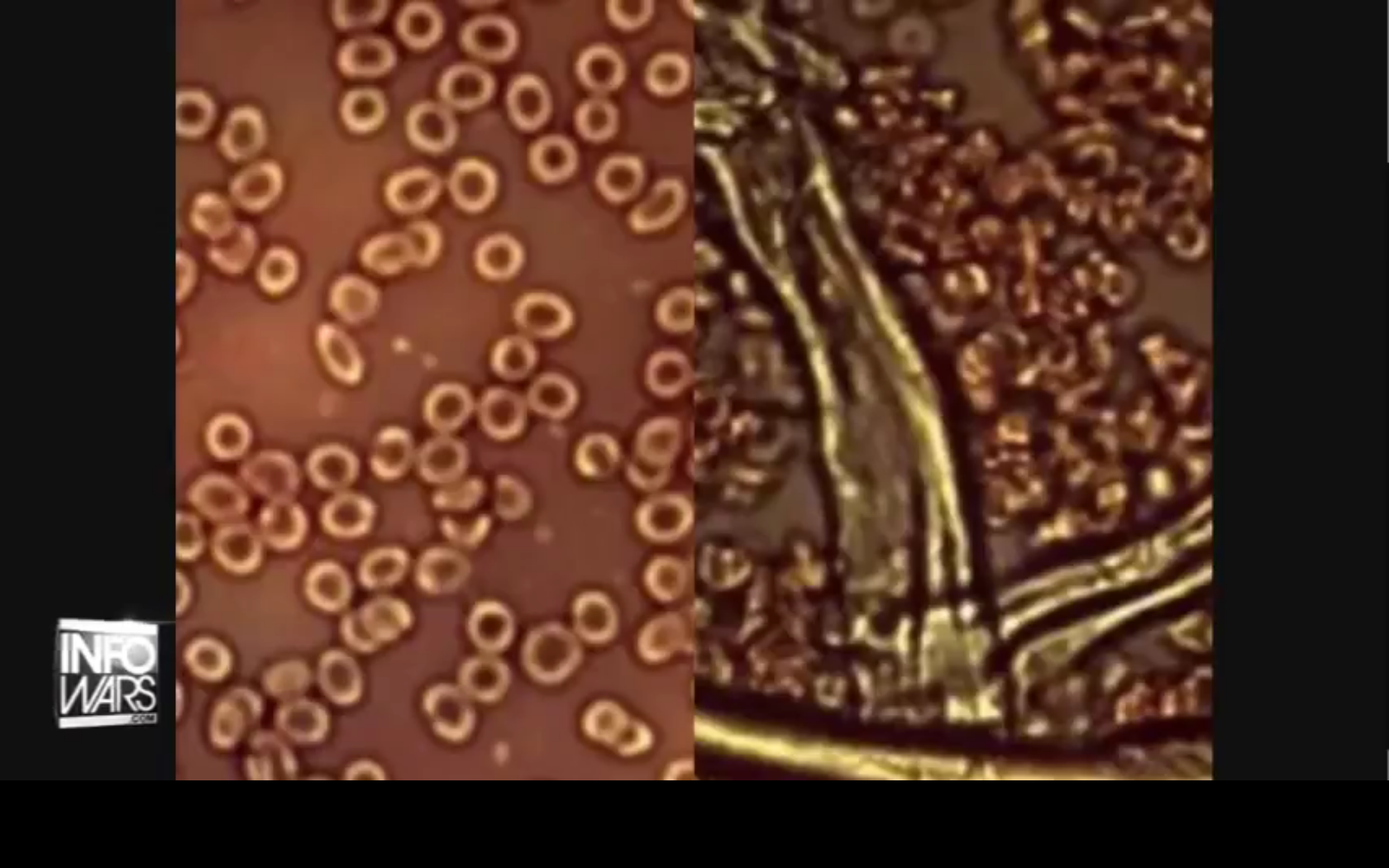 Screenshot at 2021-07-23 20:51:08 Blood Cells.png