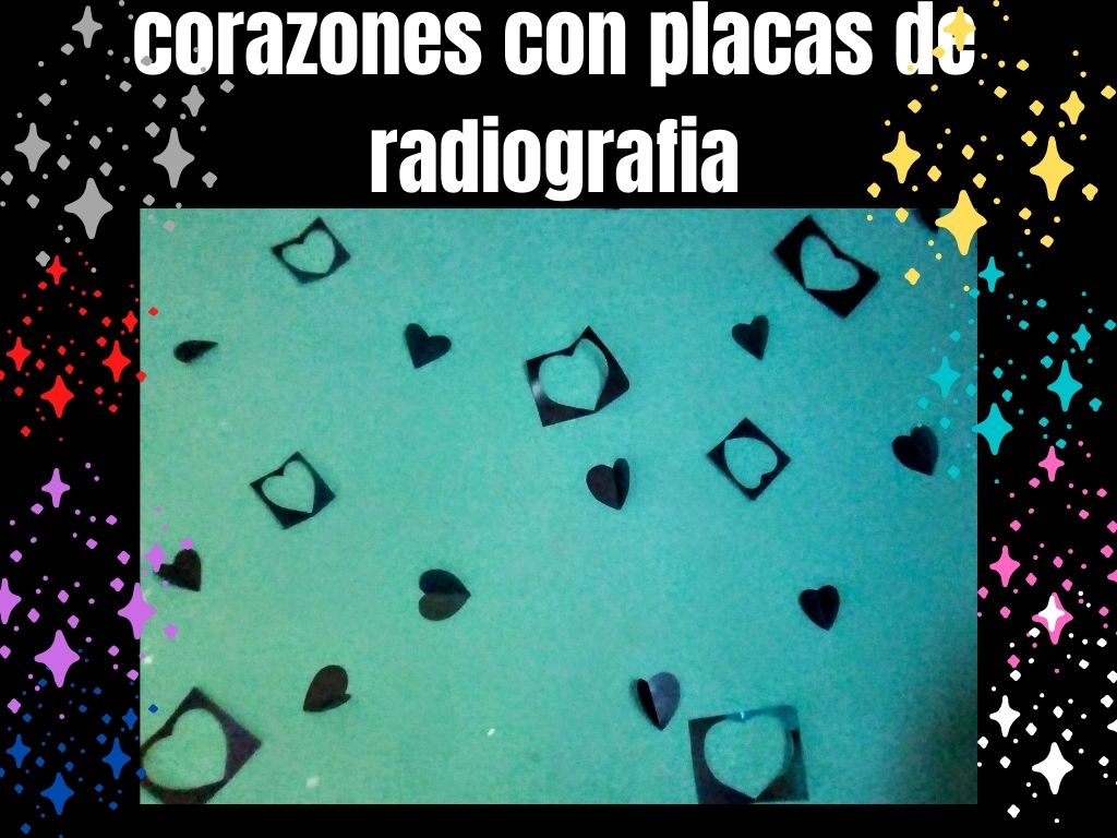 corazones con placas de radiografia.jpg