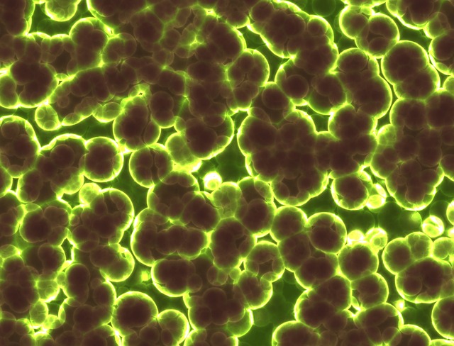 bacteria-1959386_640.jpg