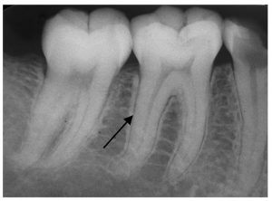 periodonto-300x222.jpg