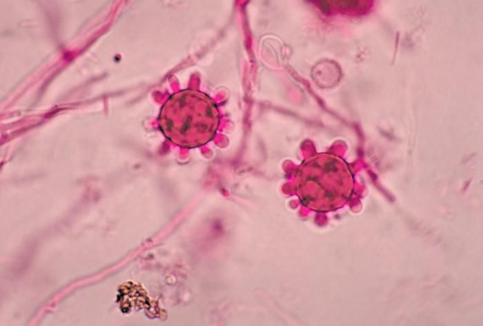 2e083ece70e958df8bdfa5f1200bed2b--microbiology-fungi.jpg