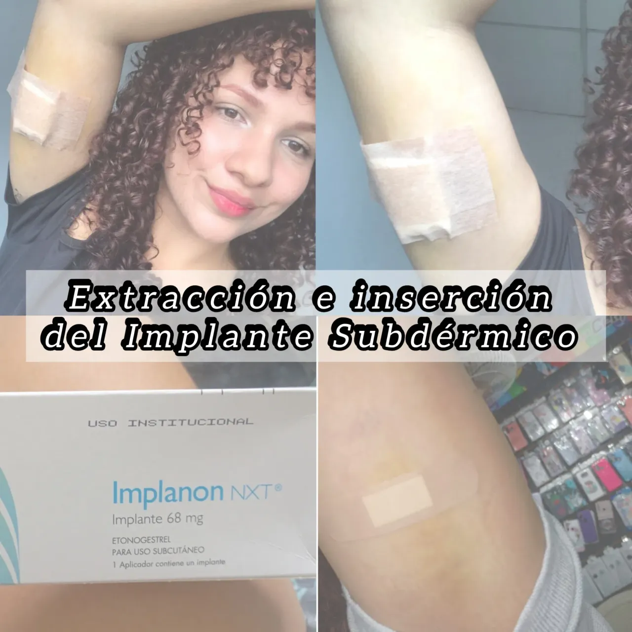 phzaaCxWuwsJrtbj_1001435971.webp