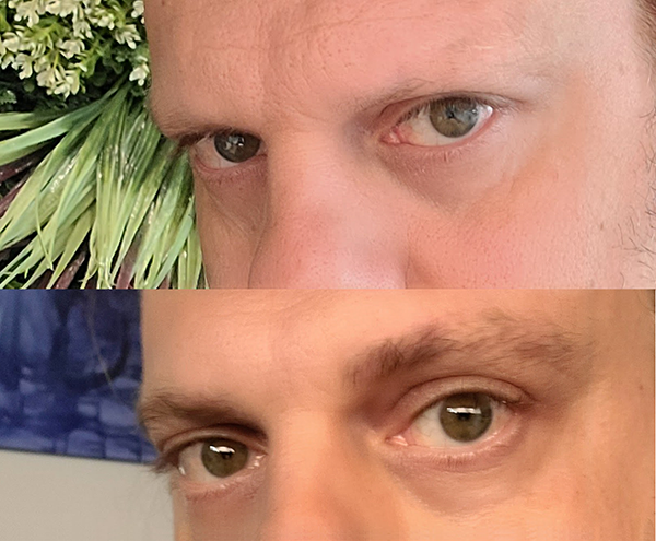 6 weeks ago VS today