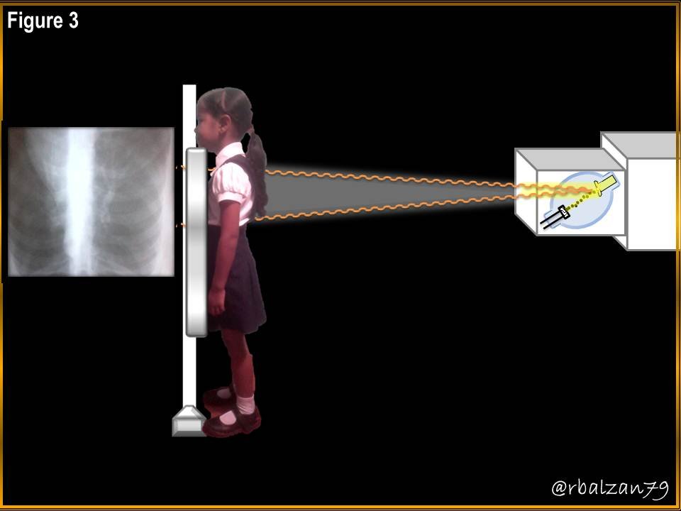 Figure_3.JPG